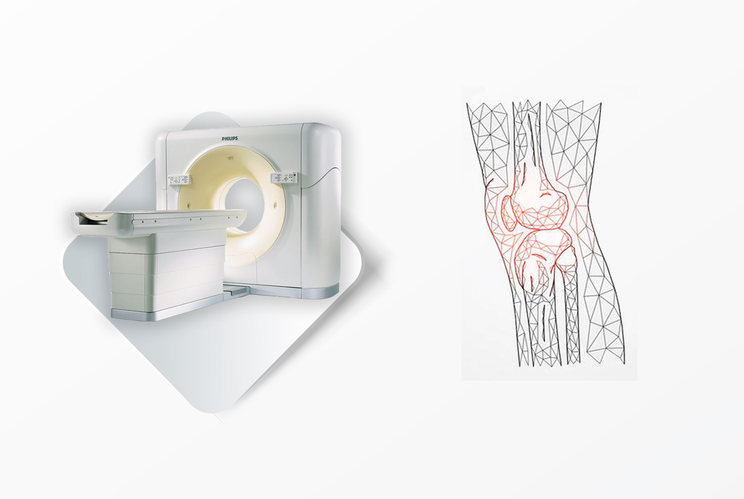 multislajsni skener koleno